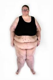 This is a support page to those who want to follow me and discuss my. My 600lb Life Transformation Gallery Inside Tlc Tlc Com