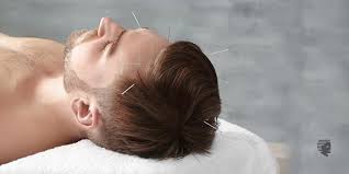43 of the test subjects were treated with acupuncture and 35 were treated with the serum, all for a form of hair loss called alopecia areata (aa). Can Acupuncture Really Affect Hair Growth Ahs India