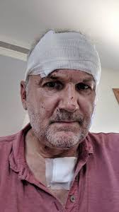 I thought Beirut blast had blinded me... but it was blood from a wound  filling up my eyes, says Brit survivor