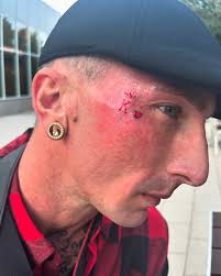 ♥️ KING of HEARTS ♥️ Artist: @_the_impossible #tattoo #tattoos #face  #facetattoo #facetattoos #viral #trending #explore