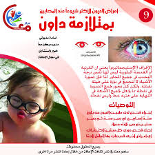 أمراض العيون عند المصابين بمتلازمة داون Poster Movie Posters Movies