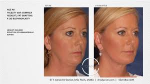 Louisville Plastic Surgery Center