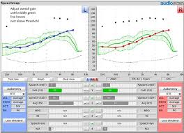 Speechmap As A Counseling And Fitting Tool Dave Smriga