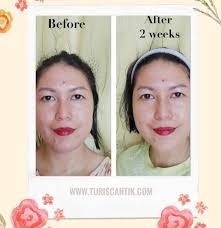 Review Skintific 5x Ceramide Barrier Repair Serum