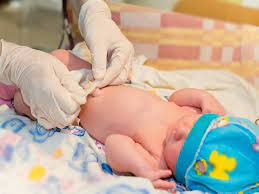 • if your baby boy has been circumcised, do not give him a tub bath until the circumcision heals. Circumcision Of Baby Boys Dr Shafeeq Ahmed S M
