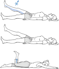 Ischiadicus mit dem lasegue test und zusätzlichem bragard zeichen. Somatische Schmerzdiagnostik Springerlink