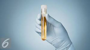 Maybe you would like to learn more about one of these? 10 Arti Warna Urine Manusia Bisa Tandakan Kondisi Kesehatan Hot Liputan6 Com