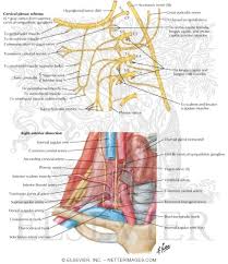 Narrowing of the carotid artery, usually due to cholesterol plaque buildup, or atherosclerosis. Nerves And Vessels Of Neck
