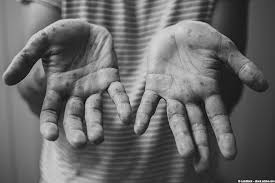 The blisters caused by hfm are red with a small bubble of fluid on top. Hand Foot Mouth Disease Causes Symptoms And Treatment