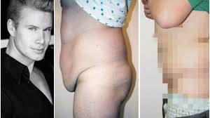 Března 2015 příběh českého modela roberta paulata (35) a jeho plastických operací zaujal i světová média. Cesky Ken Robert Paulat Pro Extra Cz Plastika Neni Jen Pro Zeny Pribeh Tohoto Chlapika Vas Dostane Extra Cz