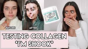 Accordingly, it is a protein that how long it takes for collagen supplements to work also depends on which supplement you take. Collagen Supplement For 30 Days Does It Work Before Afters I Can T Believe The Results Youtube