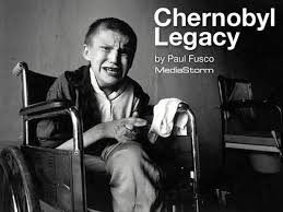 Resultado de imagen para the worst diseases caused in chernobyl and fukushima accidents