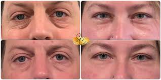 Update*** Neil A & Michelle W