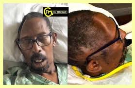 Allegedly, a Georgia man is suing an Atlanta hospital, after the staff lost  a nearly 28-square-inch piece of his skull after a routine procedure. 👀  Then billed him for a synthetic replacement