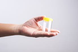 Semen Amarillo 5 Posibles Causas Y Que Hacer Tua Saude