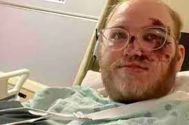 Fundraiser for Logan Higgins by Ro Gavin Chubbuck : Oh no! Our Logan!  They're broken!