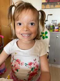 Cabelo Maluco Que Tem Escorrega De Maria Chiquinha