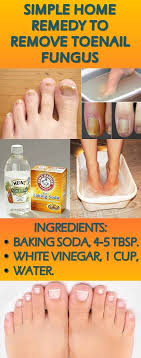 Honey represents one of the oldest and best known natural medicines. Simple Home Remedy To Remove Toenail Fungus Health Diet Fitness
