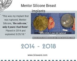 Pin On Breast Implant Illness Bii