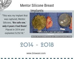 pin on breast implant illness bii