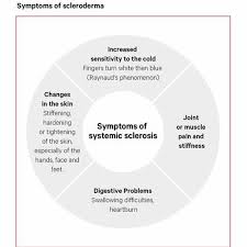 Image result for Systemic Sclerosis