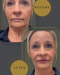 Boundless Beauty & Wellness