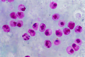 It is capable of causing disease both in immunocompetent and immunocompromised hosts. M Ad J S On Twitter Foodborneillness Cryptosporidiosis Causative Agent Cryptosporidium Parvum Onset 1 30 Days Clinical Symptoms Diarrhea Sometimes Fever Nausea And Vomiting Cryptosporidiosis Foodborneparasites Foodsafety Safefood