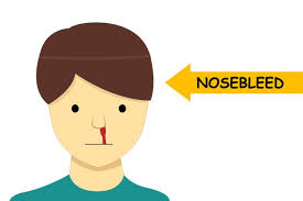 Epistaxisul este o afectiune comuna care apare atat la fete, cat si la baieti. Copilul Cand Ii Curge Sange Din Nas Qbebe Ro