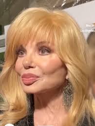 RIP Loni Anderson .. I hope it had nothing to do with all the plastic in  your face.. Why do women do this to themselves?? She looks like a cartoon  character.