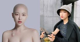갑상선기능항진증이 있으면 피부 혈류량이 증가해 피부 표면의 온도가 높아진다. Twwwsdx8spp5km