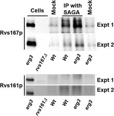 Get all of hollywood.com's best movies lists, news, and more. The Saga Complex Together With Transcription Factors And The Endocytic Protein Rvs167p Coordinates The Reprofiling Of Gene Expression In Response To Changes In Sterol Composition In Saccharomyces Cerevisiae Molecular Biology Of