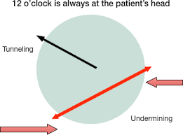 207_wound Care Module 09