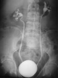 In this quiz, you will get to test out just how good of a radiologist you would make or do make. Radiology Quiz Urology News