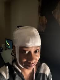 Experiencing grand mal seizures after EEG test