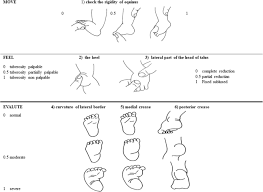 Maybe you would like to learn more about one of these? What A Paediatrician Should Know About Congenital Clubfoot Italian Journal Of Pediatrics Full Text