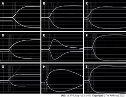 Image result for Thromboelastography