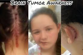 Fundraiser by Crystal Gagnon : 1 Child with 2 Brain Tumors