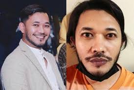 Karl Shafek sakit lagi, mata kiri bernanah... nampak macam ada semut  merayap