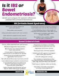 Diagnosing Bowel Endometriosis Endometriosis Specialist