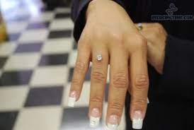 Ring Finger Microdermals Piercing Finger Piercing Microdermal Piercing Dermal Piercing