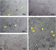 Cryptosporidium parvum'un yol açtığı enfeksiyonlarda genellikle sulu ishal görülürken diğer 3 türde 1.1.1.1. Pdf The 100 Faces Of Cryptosporidium Parvum Semantic Scholar