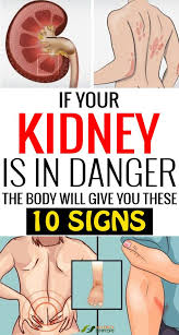 10 Signs Your Body Shows Your Kidneys Are At Danger Kidney Disease Diet Kidney Health Remedies For Kidney Infection