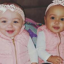 The Hoopla Over These Rare Biracial Twins Twins Reveals How Confused People Are About Racial Identity Vox