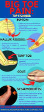 Image result for Hallux Varus