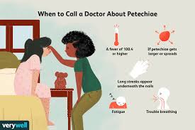 Definition allergic purpura (ap) is an allergic reaction of unknown origin causing red patches on the skin and other symptoms. Petechiae Overview And More