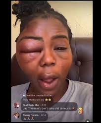 YOOOOOOOOOOO😭😭😳😳😳😳 I GOT SOOOOO MANY QUESTIONS😭😭😭😭😭, Y’ALL THINK  HER EYE WENT BACK TO NORMAL😭 ??? , #explore #explorepage #trending  #instagram #repost #mryooooooooooo #viral #fyp #foryou #foryoupage ...
