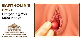 Image result for Bartholin's gland abscess