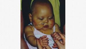 Triple-organ recipient Daisy Friedman looks to the future