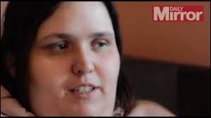 Too fat to work' but doesn't want to lose weight to keep the disability  benefits