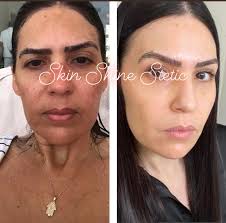 Introduction to skin care services in Springboro